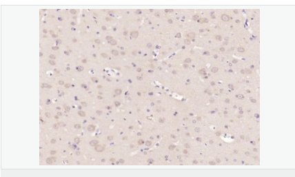 6051b2bb35043.png image.png