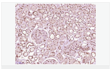 6057fd3081fc2.png image.png