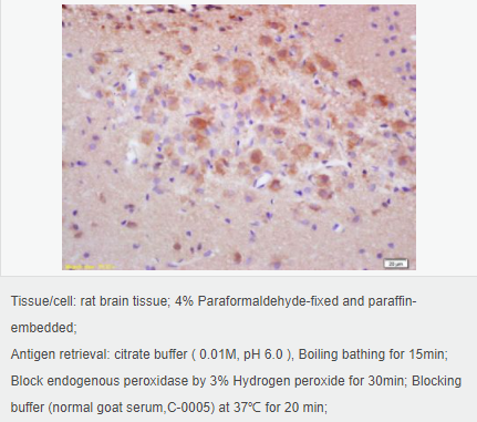 60594c258fe6b.png image.png