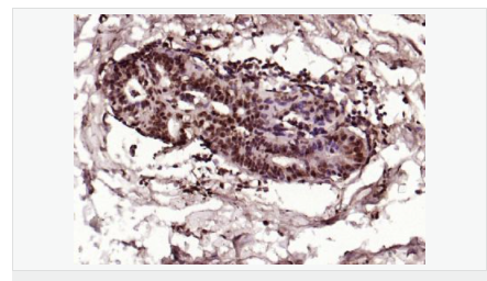 60595211800fc.png image.png