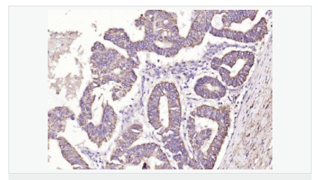 6059a61d3017b.png image.png