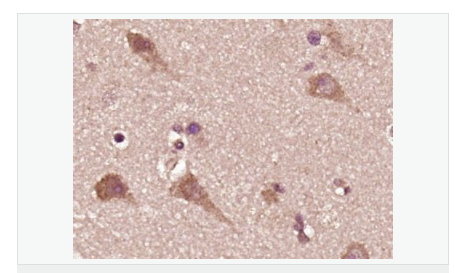 605da04d45a2e.png image.png