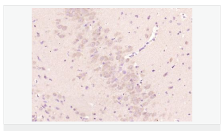 60612e500d592.png image.png