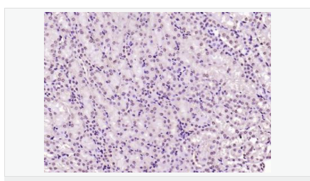 606531ea2b3b2.png image.png