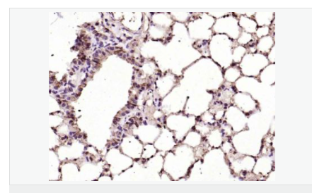 6076467ce697f.png image.png