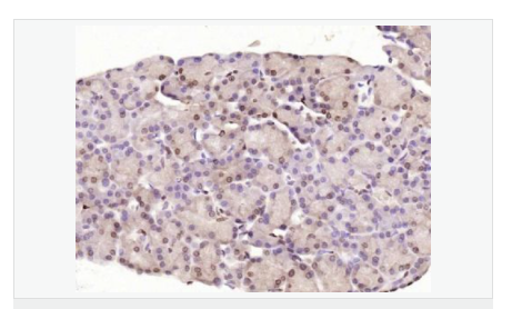 6076492b7887c.png image.png