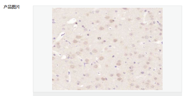 6077f1ba11a4a.png image.png